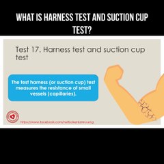 Understanding Harness and Suction Cup Tests: Key Methods for Injury Assessment 🧪