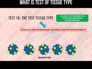 Understanding the Test of Tissue Type 🧫: How It Identifies Leukocyte Antigens
