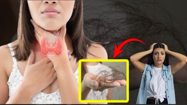 थायरॉइड में बाल क्यों झड़ते है, Thyroid Me Baal Jhadne Ka Kaaran | HairFall Reason In Thyroid..