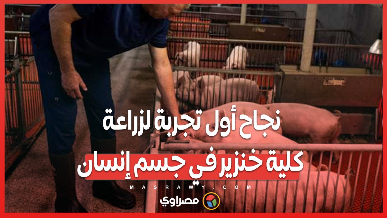 بعد شهرين نجاح أول تجربة لزراعة كلية خنزير في جسم إنسان