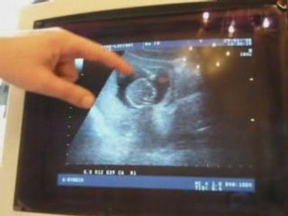 Une petite fille du soleil ...de 14 semaines