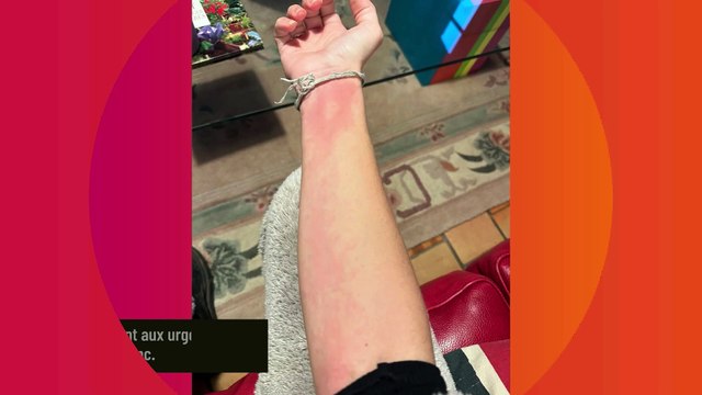 Alain Chabat : Sa fille Louise a survécu aux complications qui ont coûté la vie de Michel Blanc, elle raconte