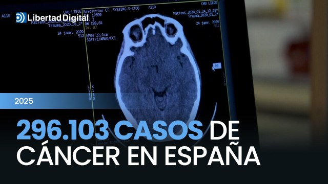 El cáncer en España sumará 296.103 nuevos diagnósticos en 2025, un incremento del 3,3% respecto al año anterior