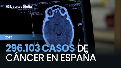 El cáncer en España sumará 296.103 nuevos diagnósticos en 2025, un incremento del 3,3% respecto al año anterior