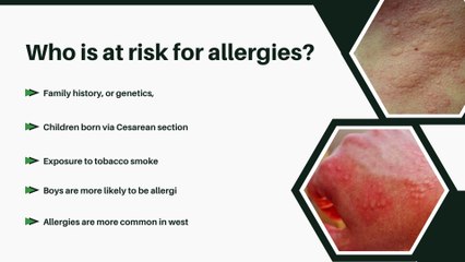 ✅ Allergy  ✅ Explained By Dr K Warraich ✅ #allergy #skinallergy