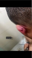 VÍDEO: veja como ficou o policial baleado pelo CV em Tancredo Neves