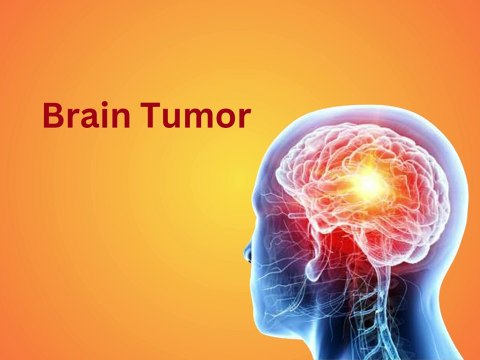 Brain tumor in Hindi, brain cancer in Hindi, symptoms of brain tumor,