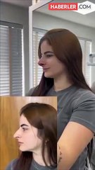 Burun estetiği yaptırdı, görenler şaşkın: Eski hali daha iyiydi