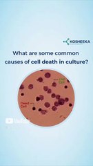 Top Causes of Cell Death in Culture & How to Prevent Them 🧬
