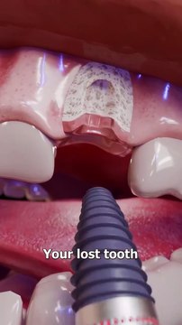 Electricity Generating Tooth😬😯! PLEASE❤✨