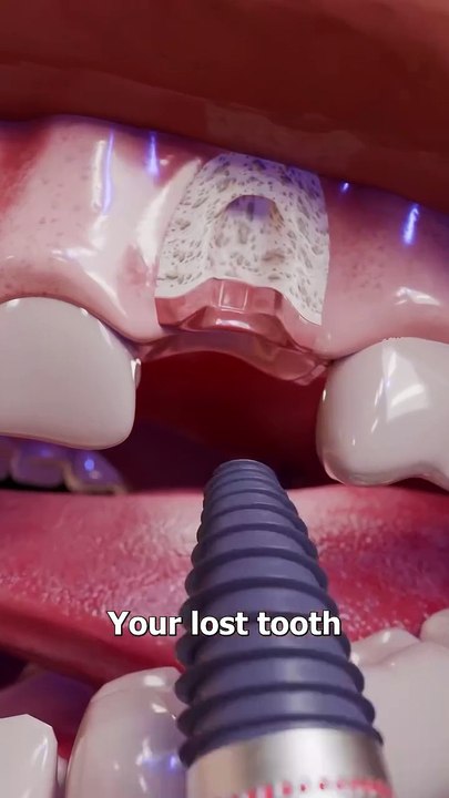 Electricity Generating Tooth😬😯!   PLEASE❤✨