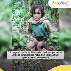 Viral! Bocah 10 Tahun di Nias Selatan Diduga Dianiaya Hingga Kakinya Patah