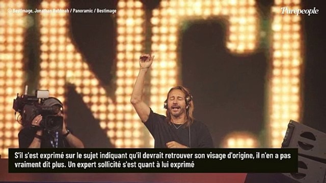 Il a dû faire une... : Le visage transformé de Bob Sinclar enfin expliqué par un expert en médecine esthétique