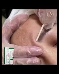 Nicotinamide Dark Spot Freckles Fade cream || Anti-wrinkle Cream || Korean Skin Care