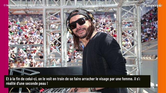 Bob Sinclar met fin au mystère sur son visage transformé, on a enfin une explication !