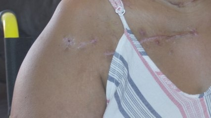 Este es el testimonio de una mujer que fue víctima de un intento de femicidio