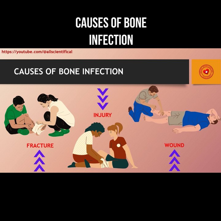 Causes of bone infection