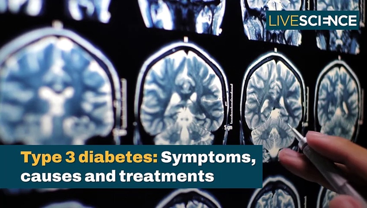 What Is Type 3 Diabetes?