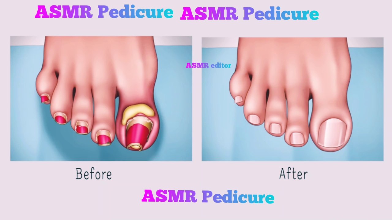 ASMR aura , sigmeaditior  Chewing asmr satisfying asmrsounds asmrcommunity slime #oddlysatisfying #mukbang #satisfyingvideos #asmrvideo #asmreating #explorepage #asm food #slimeasmr #asmrsponge #mukbangasmr #