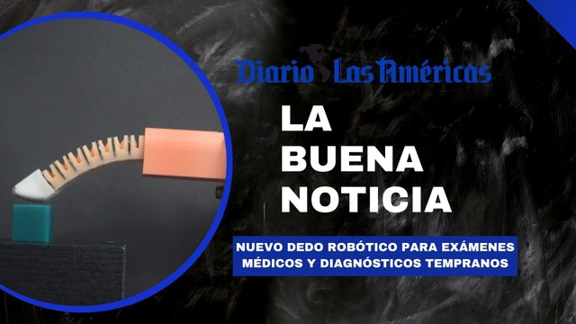 Nuevo dedo robótico para exámenes médicos y diagnósticos tempranos | La buena noticia