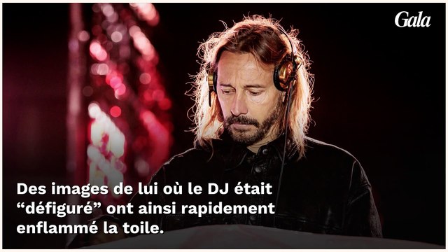 Bob Sinclar “défiguré” pour les besoins de son dernier clip : “J’étais devenu un monstre”