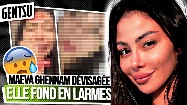 Maeva Ghennam est défigurée, elle craque 😰