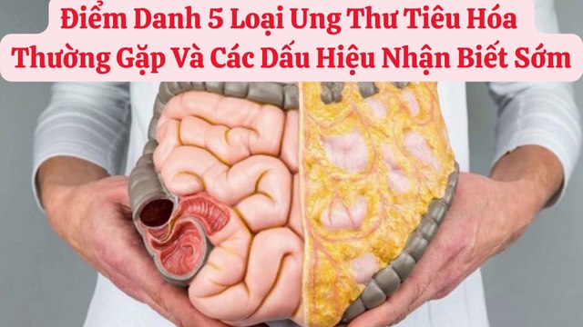 Điểm Danh 5 Loại Ung Thư Tiêu Hóa Thường Gặp Và Các Dấu Hiệu Nhận Biết Sớm