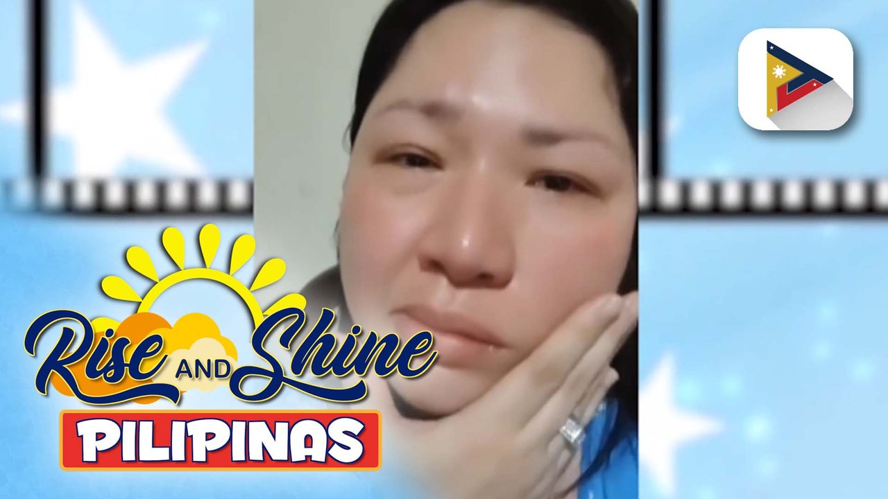 TALK BIZ | Singer at aktres na si Frenchie Dy, muling na-diagnose na may Bell's palsy