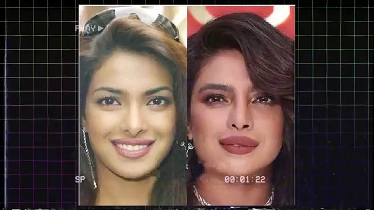 Skin Doctor Revealed It All🤯: Home Remedies, Magic Facial, Injections & Skin Brightening.