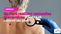 En Perú realizan campañas preventivas contra el cáncer de piel