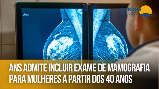 ANS admite incluir exame de mamografia para mulheres a partir dos 40 anos