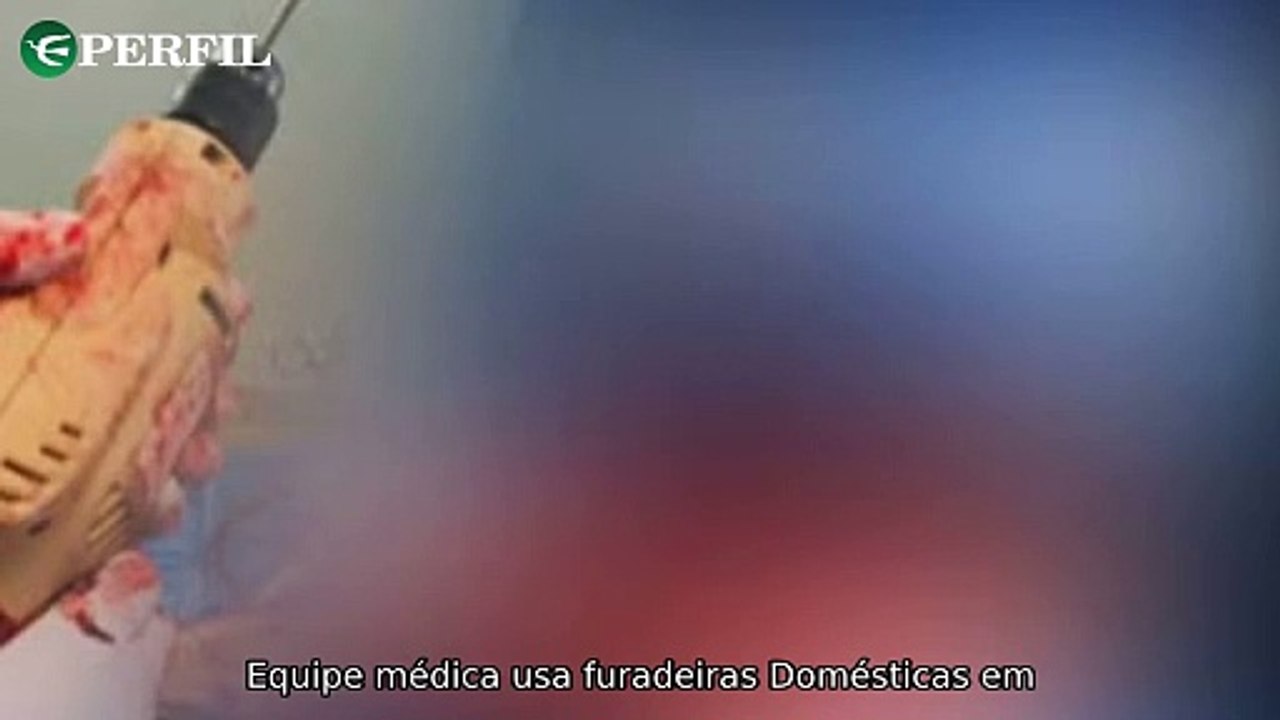 "Escândalos no BBB 25: Médicos usam furadeiras em cirurgia enquanto Rita Lobo deixa GNT após 12 anos"
