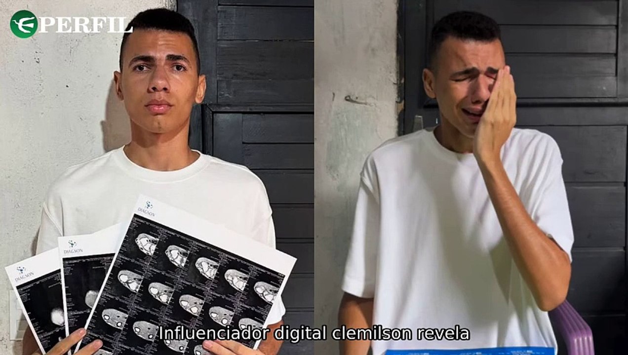 "Influenciador revela diagnóstico de tumor, Drayson Menezzes em Beleza Fatal e descontos no Watch Ultra 2 da Apple"