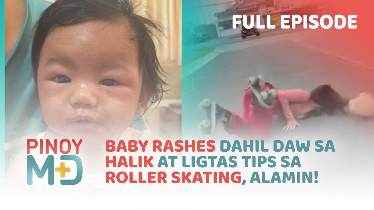 Baby rashes dahil daw sa halik at ligtas tips sa roller skating, alamin! (Full Episode) | Pinoy MD