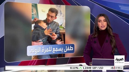 لقطة مؤثرة.. طفل سوري يسمع للمرة الأولى بعد عملية زرع قوقعة على يد الفريق الطبي السعودي التطوعي