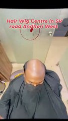 Hair Patch Service in Mumbai | Hair Replacement in Mumbai