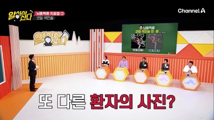 ※터지기 전까지 증상이 없다고?!※ 그것이 궁금하다, 뇌동맥류의 원인과 치료법!