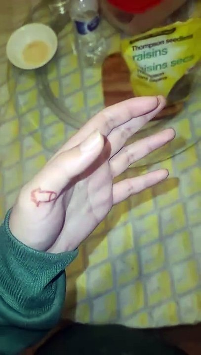 21 fingers