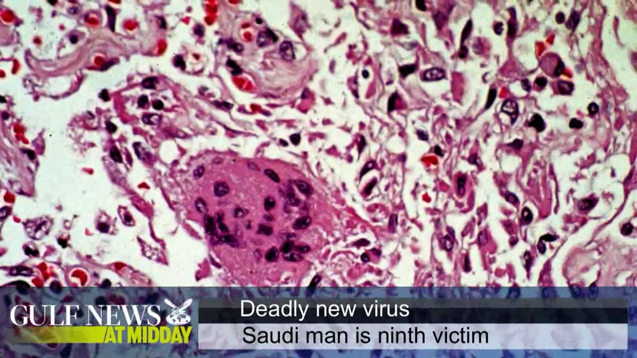 Saudi victim of SARS-like virus dies - GN Midday Wednesday Mar 13 2013