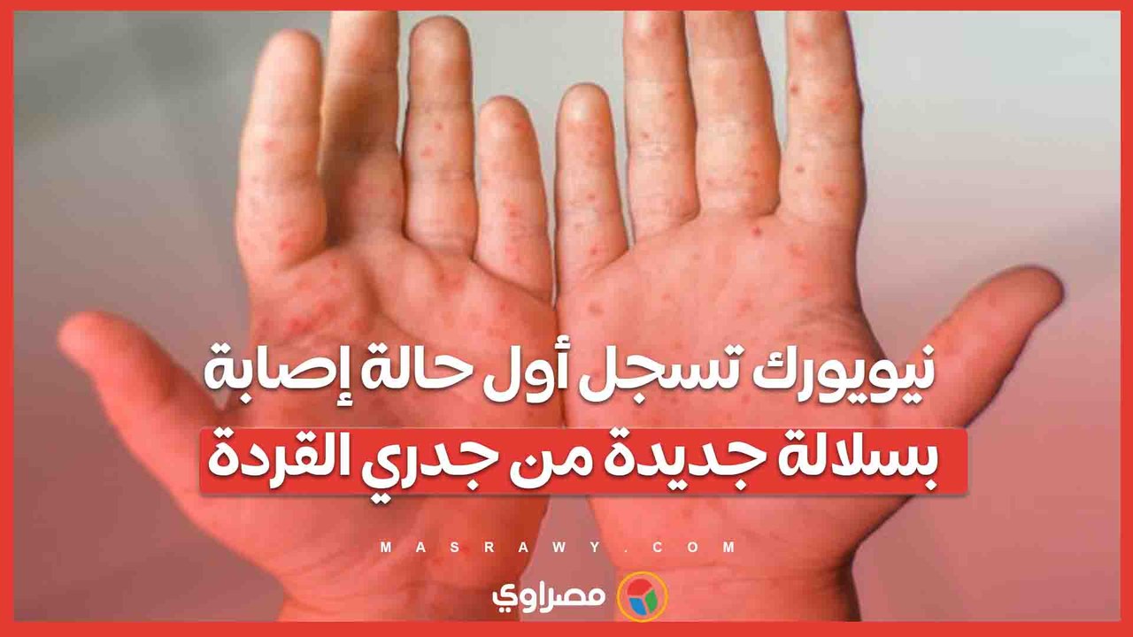 نيويورك تسجل أول حالة إصابة بسلالة جديدة من ج...