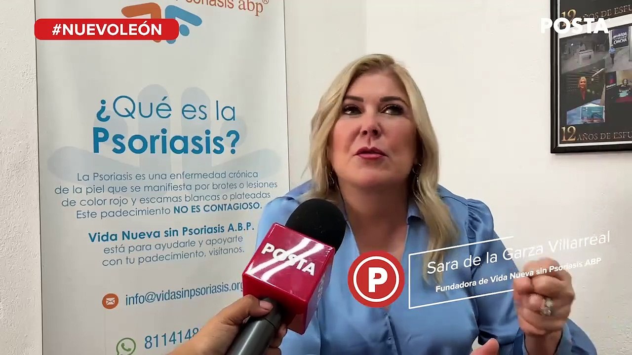 Psoriasis, enfermedad que daña la piel, articulaciones y salud mental