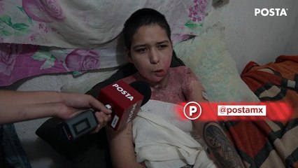 Mujer que fue quemada y violada busca salir de Nuevo León