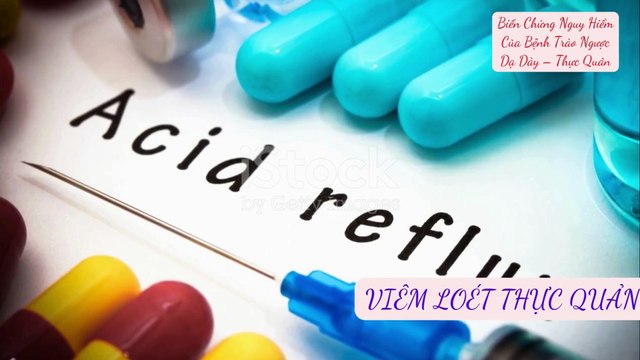 Biến Chứng Nguy Hiểm Của Bệnh Trào Ngược Dạ Dày - Thực Quản