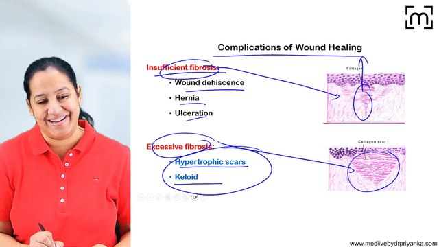 3. Factors affecting wound healing and Complications of Wound