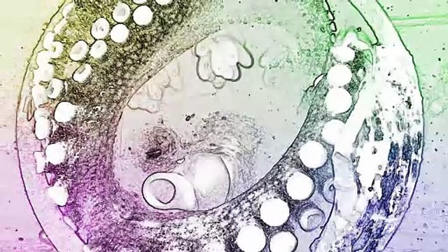 Why Do Octopuses Tear Themselves Apart After Mating?