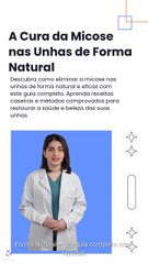 A Cura da Micose nas Unhas de Forma Natural: Receitas Caseiras Comprovadas para Unhas Saudáveis