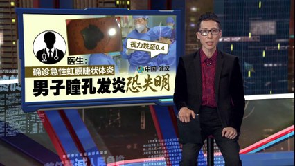 春节连续熬夜追剧打游戏，男子瞳孔变“花瓣状”险失明！🚨