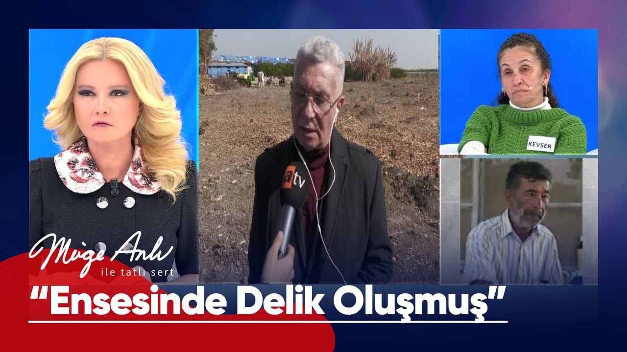 "Ensesinde serçe parmak girecek şekilde delik oluşmuş" - Müge Anlı ile Tatlı Sert 17 Şubat 2025