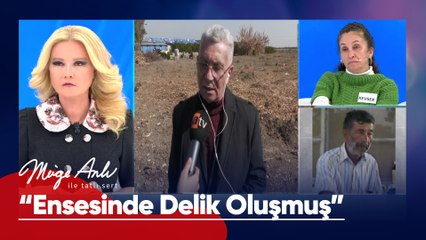 "Ensesinde serçe parmak girecek şekilde delik oluşmuş" - Müge Anlı ile Tatlı Sert 17 Şubat 2025