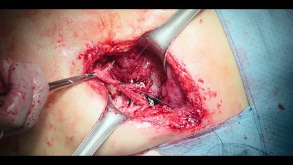 Latest Korean drama Hindi dubbed